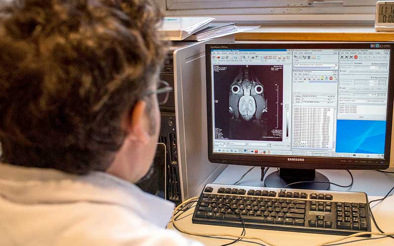 La investigación doctoral desarrolla la conexión cerebro-computador, la cual forma parte de la neuroingeniería. Foto: Philippe Merle / AFP.