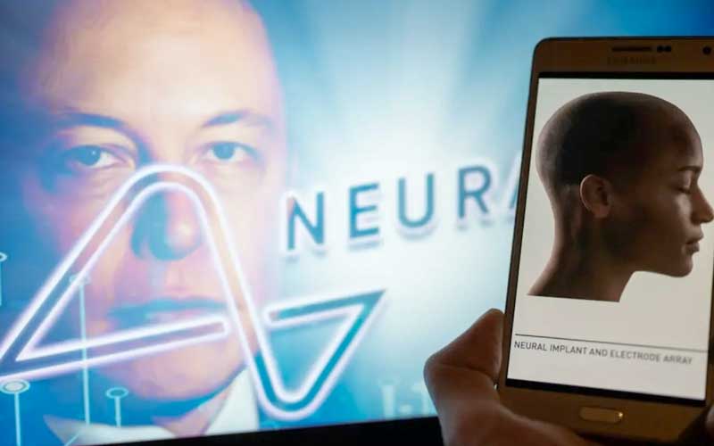 ela-elon-musk-tiene-a-miles-de-personas-haciendo-cola-para-implantarse-un-chip-en-el-cerebro-esto-es-todo-lo-que-se-sabe-de-la-cirugia-de-neuralink