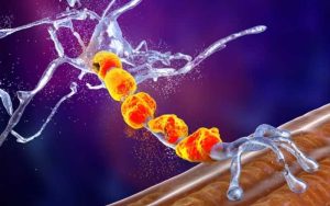 Descubren cómo frenar la progresión de la ELA al rejuvenecer las neuronas