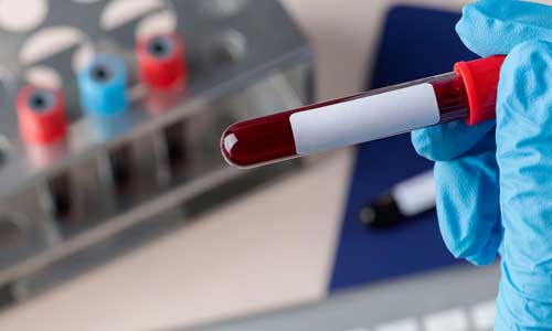 El hallazgo podría cambiar el diagnóstico temprano de la esclerosis lateral amiotrófica. (Freepik)